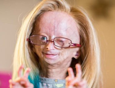 Did Adalia Rose die? Her Wiki: Age, Parents, Funeral, As a Baby, Net Worth, Family, Story